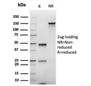 SDS-PAGE analysis of purified, BSA-free recombinant CD86 antibody (clone rC86/6872) as confirmation of integrity and purity.
