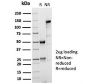 SDS-PAGE analysis of purified, BSA-free recombinant CD35 antibody (clone CR1/7016R) as confirmation of integrity and purity.