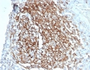 IHC staining of FFPE human kidney tissue with recombinant CD35 antibody (clone CD35/7016R) at 2ug/ml. HIER: boil tissue sections in pH 9 10mM Tris with 1mM EDTA for 20 min and allow to cool before testing.