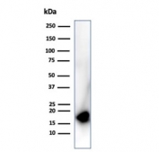 Western blot testing of human HepG2 cell lysate using CDKN2A antibody (clone rCDKN2A/4845). Predicted molecular weight ~16 kDa.