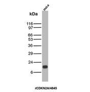 CDKN2A Antibody HeLa WB. Western blot analysis of Cyclin-dependent kinase inhibitor 2A (p16INK4a) expression in human HeLa cell lysate using CDKN2A Antibody clone rCDKN2A/4845. Lane 1: HeLa cell lysate. A band is detected at approximately 15-17 kDa, consistent with the predicted molecular weight of p16INK4a, a cyclin-dependent kinase inhibitor that regulates G1 cell cycle progression through inhibition of CDK4 and CDK6.