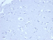 Negative control: IHC staining of FFPE human brain tissue using recombinant p21WAF1 antibody (clone rCIP1/6907) at 2ug/ml in PBS for 30min RT. HIER: boil tissue sections in pH 9 10mM Tris with 1mM EDTA for 20 min and allow to cool before testing.