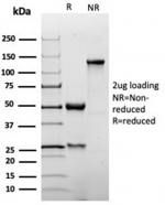 SDS-PAGE analysis of purified, BSA-free recombinant p27Kip1 antibody (clone KIP1/1355R) as confirmation of integrity and purity.