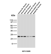 p27Kip1 Antibody Multi-Species Skeletal Muscle WB. Western blot analysis of p27Kip1 / CDKN1B expression across skeletal muscle lysates from multiple species using p27Kip1 antibody clone KIP1/1355R. Lane 1: human skeletal muscle lysate, Lane 2: mouse skeletal muscle lysate, Lane 3: rat skeletal muscle lysate, Lane 4: hamster skeletal muscle lysate, Lane 5: guinea pig skeletal muscle lysate, Lane 6: rabbit skeletal muscle lysate. A band is detected at approximately 27-29 kDa in all samples, consistent with the predicted molecular weight of p27Kip1 (CDKN1B), a cyclin-dependent kinase inhibitor that regulates cell cycle progression. The consistent signal across species supports the use of this clone for cross-species western blot analysis.