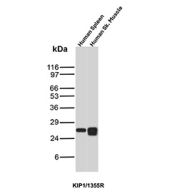 p27Kip1 Antibody Human Tissue WB. Western blot analysis of p27Kip1 / CDKN1B expression in human tissue lysates using p27Kip1 antibody clone KIP1/1355R. Lane 1: human spleen lysate, Lane 2: human skeletal muscle lysate. A band is detected at approximately 27-29 kDa in both samples, consistent with the predicted molecular weight of p27Kip1 (CDKN1B), a cyclin-dependent kinase inhibitor that regulates cell cycle progression. Detection across distinct tissue types supports the use of this clone for western blot analysis in diverse human samples.