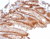 IHC staining of FFPE human kidney tissue with Reelin antibody (clone RELN/4498). HIER: boil tissue sections in pH 9 10mM Tris with 1mM EDTA for 20 min and allow to cool before testing.