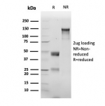 SDS-PAGE analysis of purified, BSA-free recombinant CTNND1 antibody (clone rCTNND1/6903) as confirmation of integrity and purity.