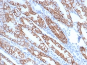 IHC staining of FFPE human stomach tissue glandular cells with recombinant CTNND1 antibody (clone rCTNND1/6903) at 2ug/ml in PBS for 30min RT. HIER: boil tissue sections in pH 9 10mM Tris with 1mM EDTA for 20 min and allow to cool before testing.