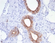 IHC staining of FFPE human salivary gland tissue with recombinant CFTR antibody (clone rCFTR/7175) at 2ug/ml. HIER: boil tissue sections in pH 9 10mM Tris with 1mM EDTA for 20 min and allow to cool before testing.