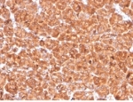 IHC staining of FFPE human pancreas tissue with Cathepsin D antibody (clone CTSD/4497). HIER: boil tissue sections in pH 9 10mM Tris with 1mM EDTA for 20 min and allow to cool before testing.