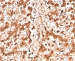 IHC staining of FFPE human liver tissue with CTSD antibody (clone CTSD/4497). HIER: boil tissue sections in pH 9 10mM Tris with 1mM EDTA for 20 min and allow to cool before testing.