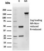 SDS-PAGE analysis of purified, BSA-free CTSD antibody (clone CTSD/4497) as confirmation of integrity and purity.