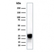 Western blot testing of human liver tissue lysate using CTSD antibody (clone CTSD/4497).