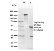 SDS-PAGE analysis of purified, BSA-free Interleukin 5 antibody (clone IL5/4161) as confirmation of integrity and purity.