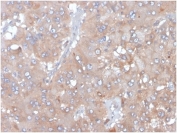 IHC staining of FFPE human adrenal gland tissue with Interleukin 5 antibody (clone IL5/4161). HIER: boil tissue sections in pH 9 10mM Tris with 1mM EDTA for 20 min and allow to cool before testing.