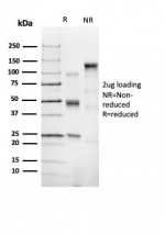 SDS-PAGE analysis of purified, BSA-free recombinant CD43 antibody (clone SPN/6562R) as confirmation of integrity and purity.