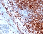 IHC staining of FFPE human tonsil tissue with recombinant CD43 antibody (clone SPN/6562R). Negative control inset: PBS instead of primary antibody to control for secondary binding. HIER: boil tissue sections in pH 9 10mM Tris with 1mM EDTA for 20 min and allow to cool before testing.