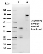 SDS-PAGE analysis of purified, BSA-free IL-2 antibody (clone IL2/3949) as confirmation of integrity and purity.