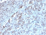 IHC staining of FFPE human adrenal gland with IL-2 antibody (clone IL2/3949). HIER: boil tissue sections in pH 9 10mM Tris with 1mM EDTA for 20 min and allow to cool before testing.