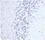 Negative control: IHC staining of FFPE human brain tissue with recombinant PSA antibody (clone KLK3/4602R) at 2ug/ml in PBS for 30min RT. HIER: boil tissue sections in pH 9 10mM Tris with 1mM EDTA for 20 min and allow to cool before testing.