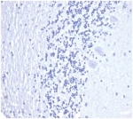 Negative control: IHC staining of FFPE human brain tissue with recombinant PSA antibody (clone KLK3/4602R) at 2ug/ml in PBS for 30min RT. HIER: boil tissue sections in pH 9 10mM Tris with 1mM EDTA for 20 min and allow to cool before testing.