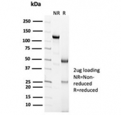 SDS-PAGE analysis of purified, BSA-free Calbindin 2 antibody (clone CALB2/7029R) as confirmation of integrity and purity.