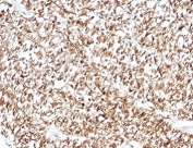 IHC staining of FFPE human brain tissue with Calbindin 2 antibody (clone CALB2/7029R). HIER: boil tissue sections in pH 9 10mM Tris with 1mM EDTA for 20 min and allow to cool before testing.