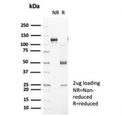SDS-PAGE analysis of purified, BSA-free recombinant Cadherin 2 antibody (clone CDH2/7070R) as confirmation of integrity and purity.