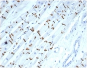 IHC staining of FFPE human heart tissue with recombinant Cadherin 2 antibody (clone CDH2/7070R). HIER: boil tissue sections in pH 9 10mM Tris with 1mM EDTA for 20 min and allow to cool before testing.