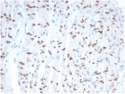 IHC staining of FFPE human heart tissue with recombinant Cadherin 2 antibody (clone CDH2/7070R). HIER: boil tissue sections in pH 9 10mM Tris with 1mM EDTA for 20 min and allow to cool before testing.