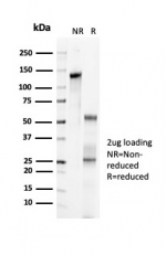 SDS-PAGE analysis of purified, BSA-free recombinant p57Kip2 antibody (clone KIP2/7083R) as confirmation of integrity and purity.