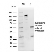 SDS-PAGE analysis of purified, BSA-free IL3 antibody (clone IL3/4001) as confirmation of integrity and purity.