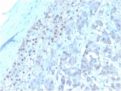 IHC staining of FFPE human adrenal gland tissue with IL3 antibody (clone I L3/4001). HIER: boil tissue sections in pH 9 10mM Tris with 1mM EDTA for 20 min and allow to cool before testing.