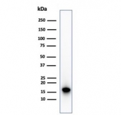 Western blot testing of human HepG2 cell lysate using recombinant p16INK4a antibody (clone CDKN2A/4844R). Predicted molecular weight ~16 kDa.