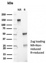 SDS-PAGE analysis of purified, BSA-free recombinant CDKN2A antibody (clone CDKN2A/7081R) as confirmation of integrity and purity.