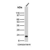 CDKN2A Antibody HeLa WB. Western blot analysis of Cyclin-dependent kinase inhibitor 2A (p16INK4a) expression in HeLa cell lysate using CDKN2A Antibody clone CDKN2A/7081R. Lane 1: HeLa cell lysate. A band is detected at approximately 15â17 kDa, consistent with the predicted molecular weight of p16INK4a, a cyclin-dependent kinase inhibitor that regulates G1 cell cycle progression through inhibition of CDK4 and CDK6.