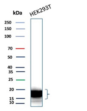CDKN2A Antibody HEK293T Cell Line WB. Western blot analysis of Cyclin-dependent kinase inhibitor 2A (p16INK4a) expression in HEK293T cell lysate using CDKN2A Antibody clone CDKN2A/7081R. Lane 1: HEK293T cell lysate. Bands are detected at approximately 15â17 kDa, consistent with the predicted molecular weight of p16INK4a, a cyclin-dependent kinase inhibitor that regulates G1 cell cycle progression through inhibition of CDK4 and CDK6. The presence of closely migrating bands may reflect isoforms, post-translational modification, or minor proteolytic processing.