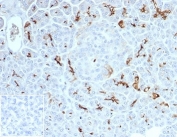 IHC staining of FFPE human pancreas tissue with recombinant Cystic Fibrosis Transmembrane Regulator antibody (clone CFTR/7154R) at 2ug/ml. Negative control inset: PBS instead of primary antibody to control for secondary binding. HIER: boil tissue sections in pH 9 10mM Tris with 1mM EDTA for 20 min and allow to cool before testing.