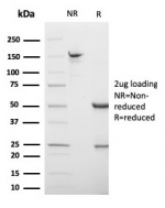SDS-PAGE analysis of purified, BSA-free S100B antibody (clone S100B/4138) as confirmation of integrity and purity.