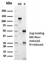 SDS-PAGE analysis of purified, BSA-free ACE antibody (clone ACE/7004R) as confirmation of integrity and purity.