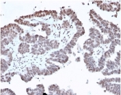 IHC staining of FFPE human prostate tissue with FOXL1 antibody (clone PCRP-FOXL1-1F8) at 2ug/ml. HIER: boil tissue sections in pH 9 10mM Tris with 1mM EDTA for 20 min and allow to cool before testing.