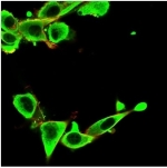 Immunofluorescent staining of PFA-fixed U-87 MG cells using IGFBP3 antibody (green, clone IGFBP3/3424) and phalloidin (red).