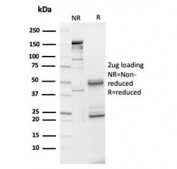 SDS-PAGE analysis of purified, BSA-free IGFBP3 antibody (clone IGFBP3/3517) as confirmation of integrity and purity.