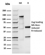 SDS-PAGE analysis of purified, BSA-free human IgA antibody (clone IGHA/3877R) as confirmation of integrity and purity.