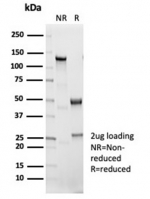 SDS-PAGE analysis of purified, BSA-free recombinant IL1 beta antibody (clone IL1B/7049R) as confirmation of integrity and purity.