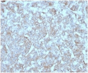 IHC staining of FFPE human adrenal gland with MCP2 antibody (clone CCL8/3312). HIER: boil tissue sections in pH 9 10mM Tris with 1mM EDTA for 20 min and allow to cool before testing.