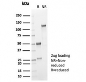 SDS-PAGE analysis of purified, BSA-free recombinant Interleukin 2 antibody (clone IL2/7051R) as confirmation of integrity and purity.