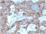 IHC staining of FFPE human adrenal gland tissue with Interleukin 3 antibody (clone IL3/4004). HIER: boil tissue sections in pH 9 10mM Tris with 1mM EDTA for 20 min and allow to cool before testing.