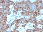 IHC staining of FFPE human adrenal gland tissue with Interleukin 3 antibody (clone IL3/4004). HIER: boil tissue sections in pH 9 10mM Tris with 1mM EDTA for 20 min and allow to cool before testing.