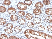 IHC staining of FFPE human small intestine with IL-3 antibody (clone IL3/4005). HIER: boil tissue sections in pH 9 10mM Tris with 1mM EDTA for 20 min and allow to cool before testing.